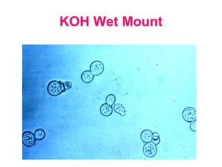 KOH Wet Mount
 