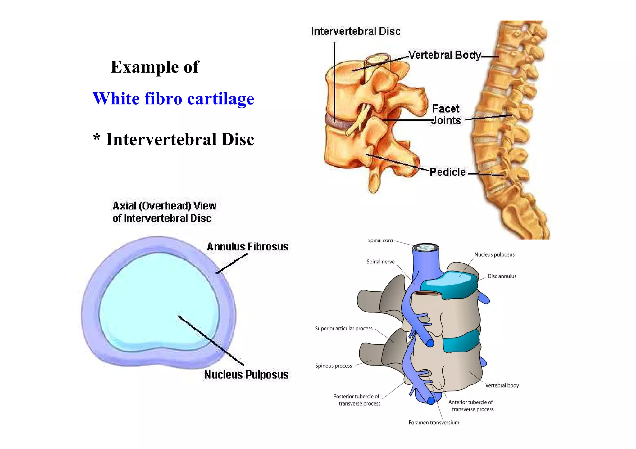 Example of
White fibro cartilage

* Intervertebral Disc
 