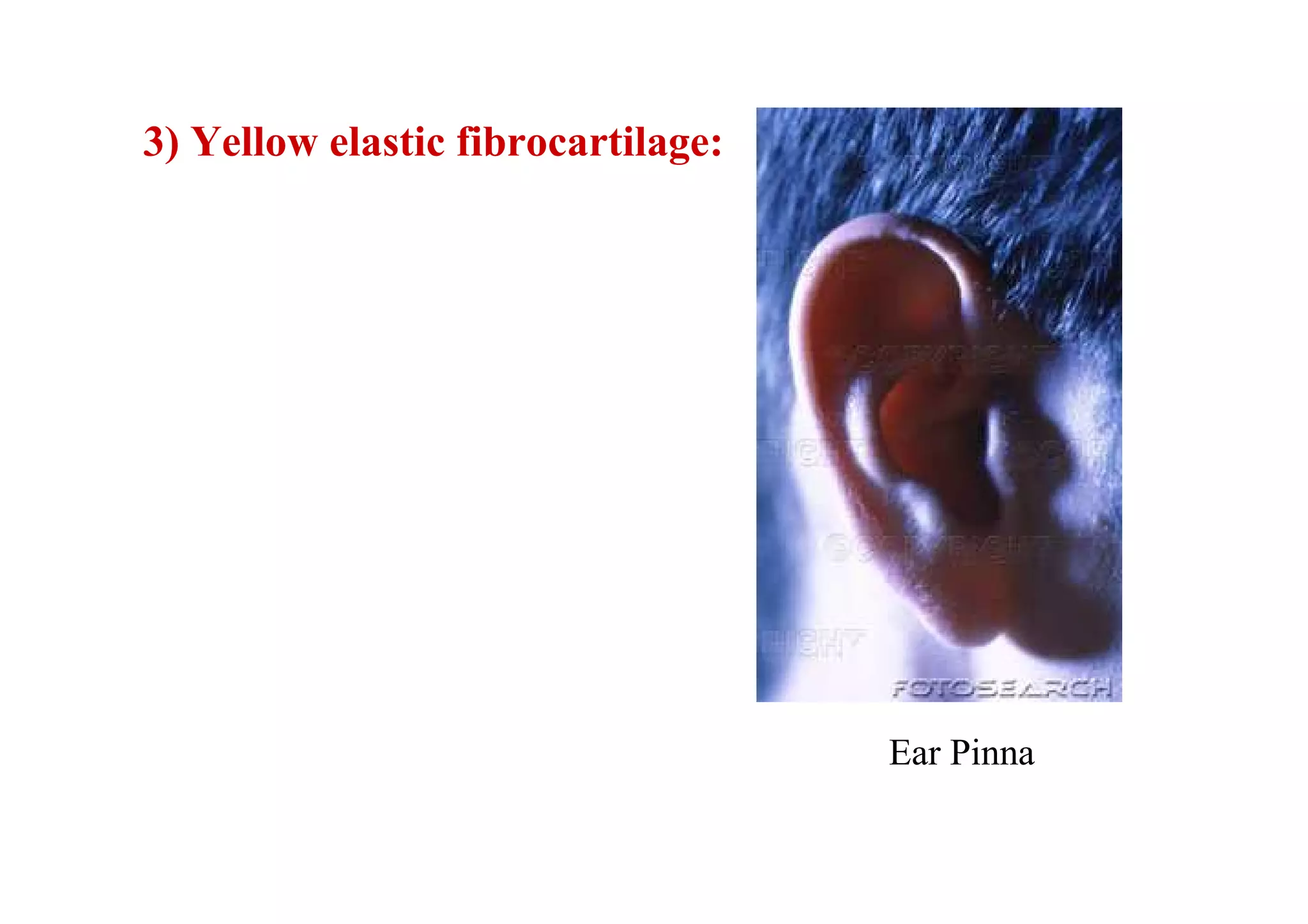 3) Yellow elastic fibrocartilage:




                                    Ear Pinna
 