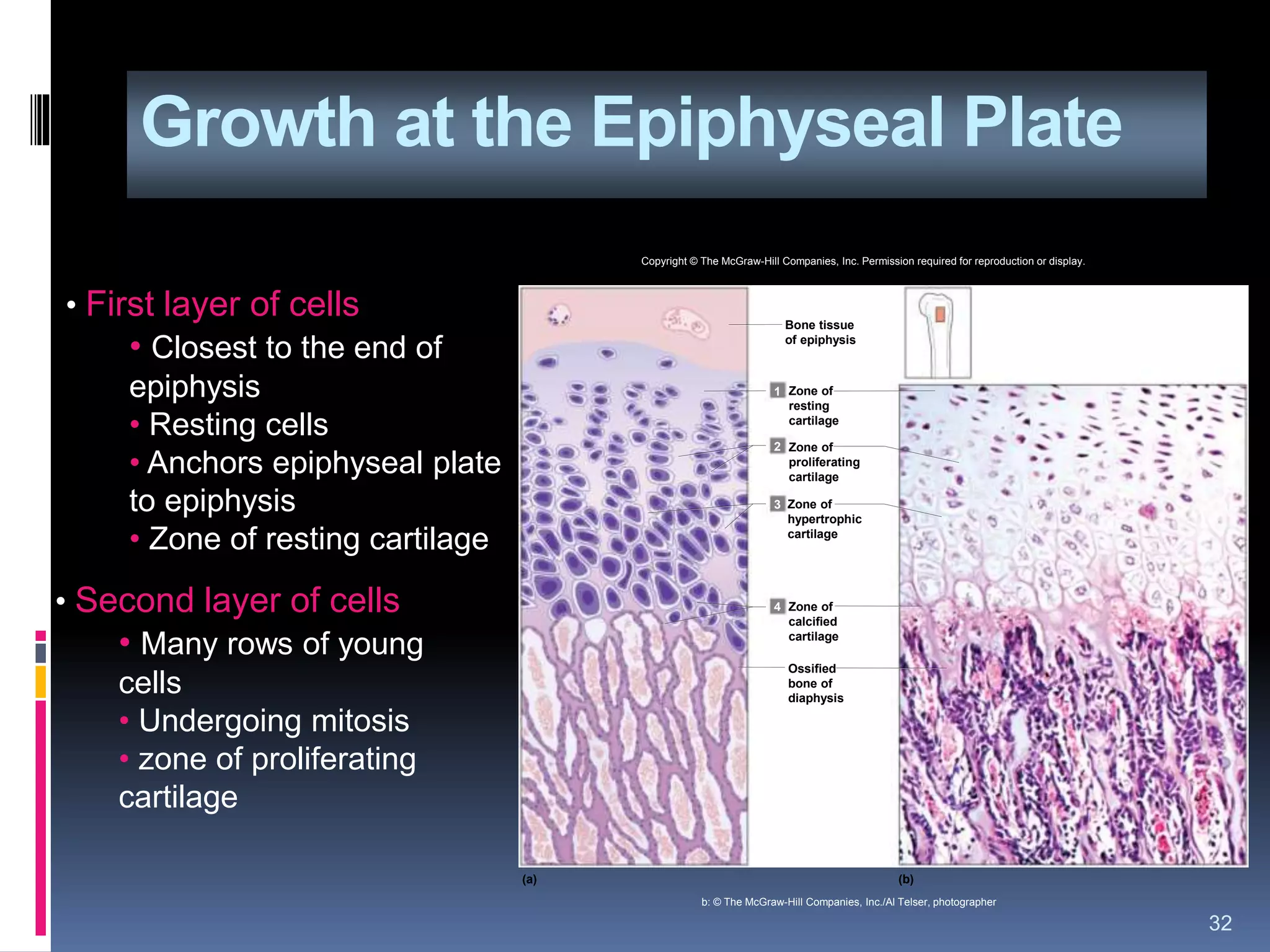 Growth at the Epiphyseal Plate
32
• First layer of cells
• Closest to the end of
epiphysis
• Resting cells
• Anchors epiphyseal plate
to epiphysis
• Zone of resting cartilage
• Second layer of cells
• Many rows of young
cells
• Undergoing mitosis
• zone of proliferating
cartilage
1
2
3
4
(a) (b)
Bone tissue
of epiphysis
Zone of
resting
cartilage
Zone of
proliferating
cartilage
Zone of
hypertrophic
cartilage
Zone of
calcified
cartilage
Ossified
bone of
diaphysis
Copyright © The McGraw-Hill Companies, Inc. Permission required for reproduction or display.
b: © The McGraw-Hill Companies, Inc./Al Telser, photographer
 