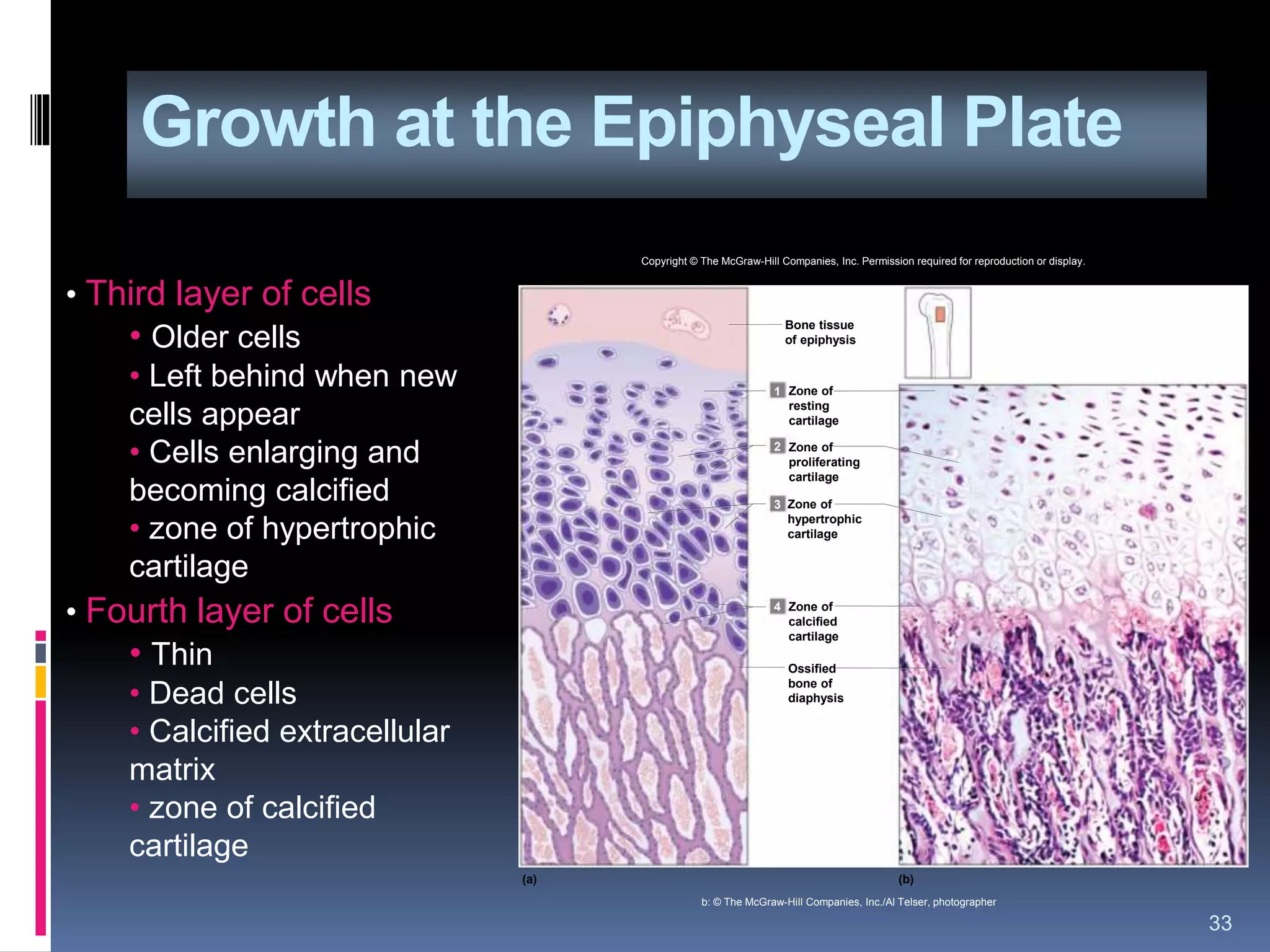 Growth at the Epiphyseal Plate
33
• Third layer of cells
• Older cells
• Left behind when new
cells appear
• Cells enlarging and
becoming calcified
• zone of hypertrophic
cartilage
• Fourth layer of cells
• Thin
• Dead cells
• Calcified extracellular
matrix
• zone of calcified
cartilage
1
2
3
4
(a) (b)
Bone tissue
of epiphysis
Zone of
resting
cartilage
Zone of
proliferating
cartilage
Zone of
hypertrophic
cartilage
Zone of
calcified
cartilage
Ossified
bone of
diaphysis
Copyright © The McGraw-Hill Companies, Inc. Permission required for reproduction or display.
b: © The McGraw-Hill Companies, Inc./Al Telser, photographer
 