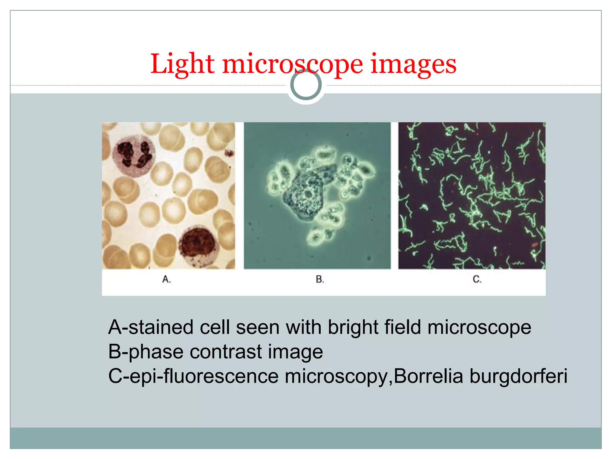 Light microscope images
A-stained cell seen with bright field microscope
B-phase contrast image
C-epi-fluorescence microscopy,Borrelia burgdorferi
 