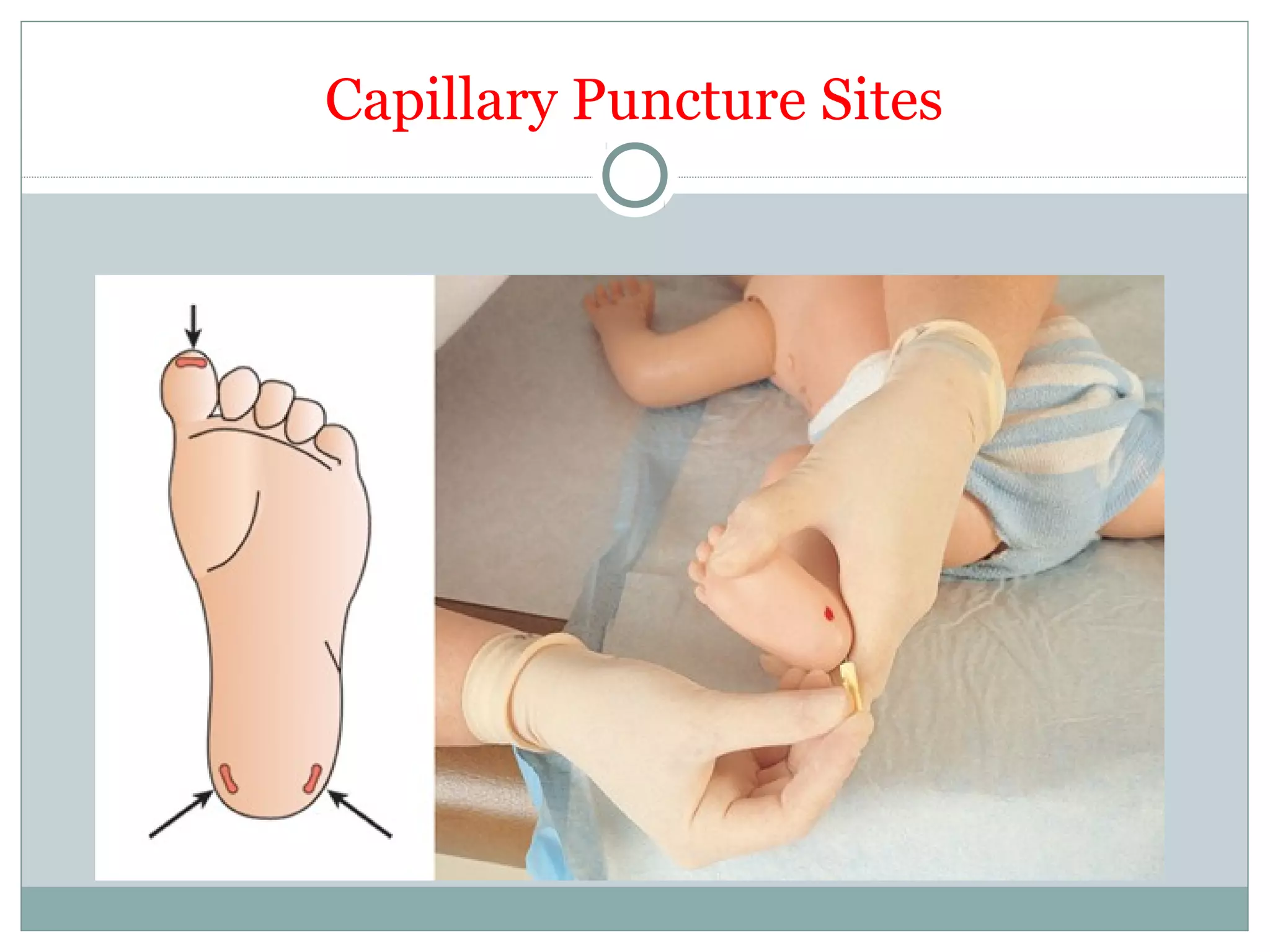 Capillary Puncture Sites
 