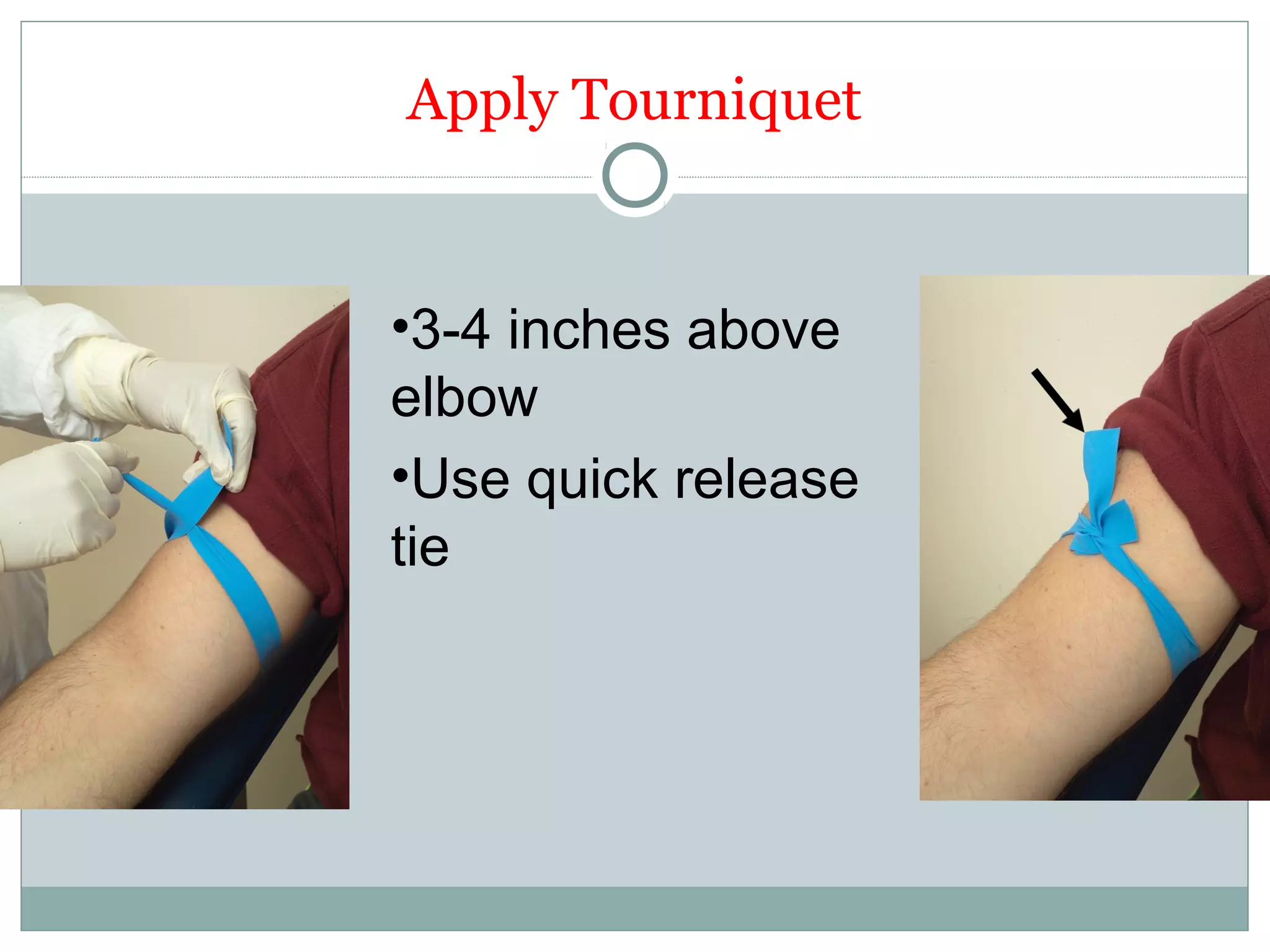 Apply Tourniquet
•3-4 inches above
elbow
•Use quick release
tie
 