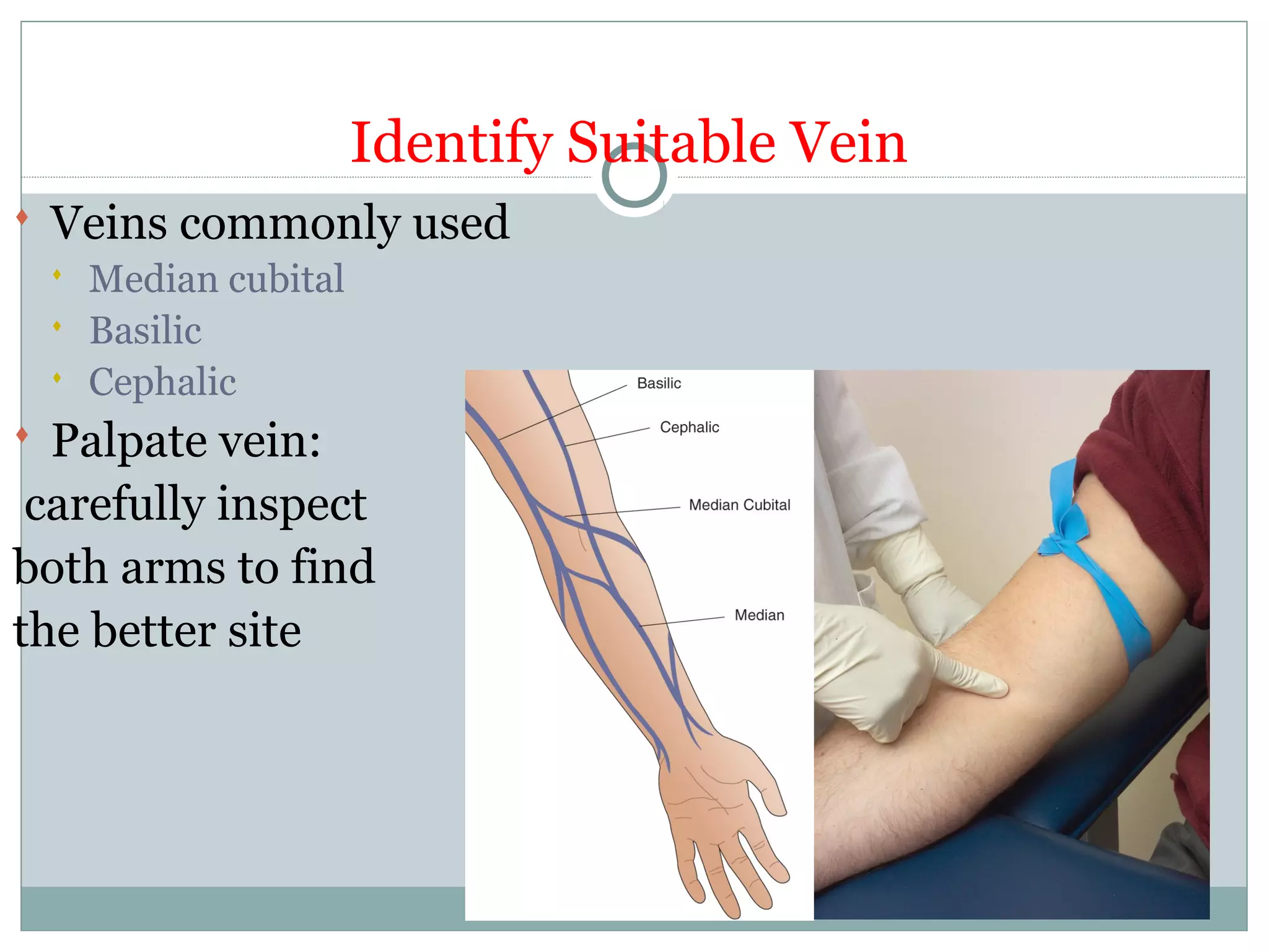 Identify Suitable Vein
 Veins commonly used
 Median cubital
 Basilic
 Cephalic
 Palpate vein:
carefully inspect
both arms to find
the better site
 