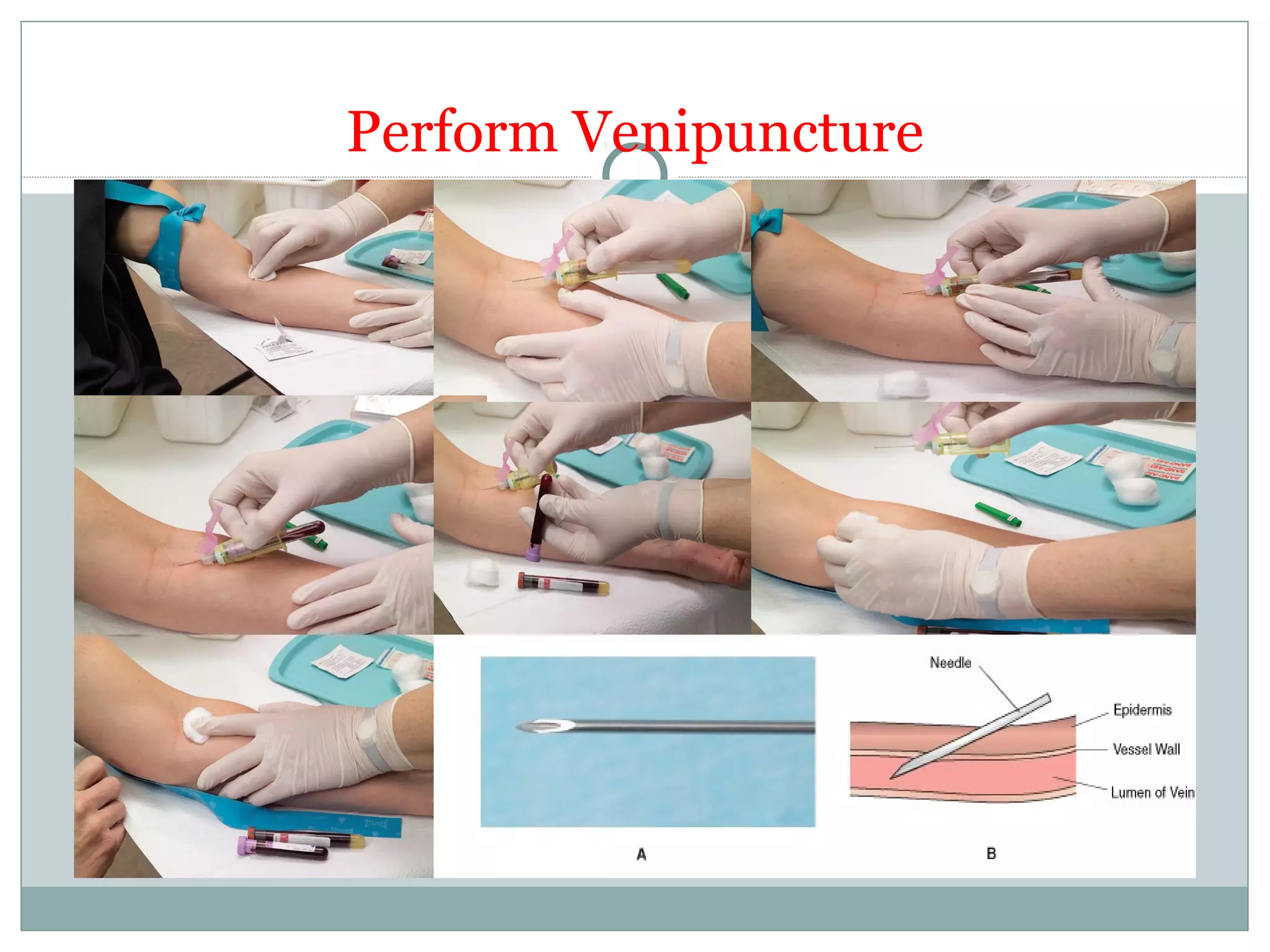 Perform Venipuncture
 