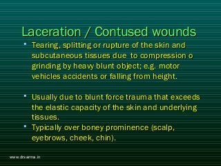 Introduction of injuries by abdinur | PPT