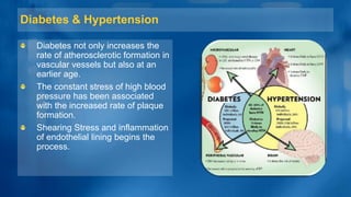 Diabetes & Hypertension
Diabetes not only increases the
rate of atherosclerotic formation in
vascular vessels but also at an
earlier age.
The constant stress of high blood
pressure has been associated
with the increased rate of plaque
formation.
Shearing Stress and inflammation
of endothelial lining begins the
process.
 