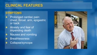 CLINICAL FEATURES
SYMPTOMS
Prolonged cardiac pain:
chest, throat. arm, epigastric
or back
Anxiety and fear of
impending death
Nausea and vomiting
Breathlessness
Collapse/syncope
 