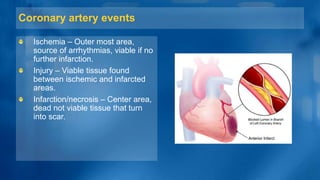 Coronary artery events
Ischemia – Outer most area,
source of arrhythmias, viable if no
further infarction.
Injury – Viable tissue found
between ischemic and infarcted
areas.
Infarction/necrosis – Center area,
dead not viable tissue that turn
into scar.
 