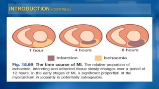INTRODUCTION (CONTINUE)
 
