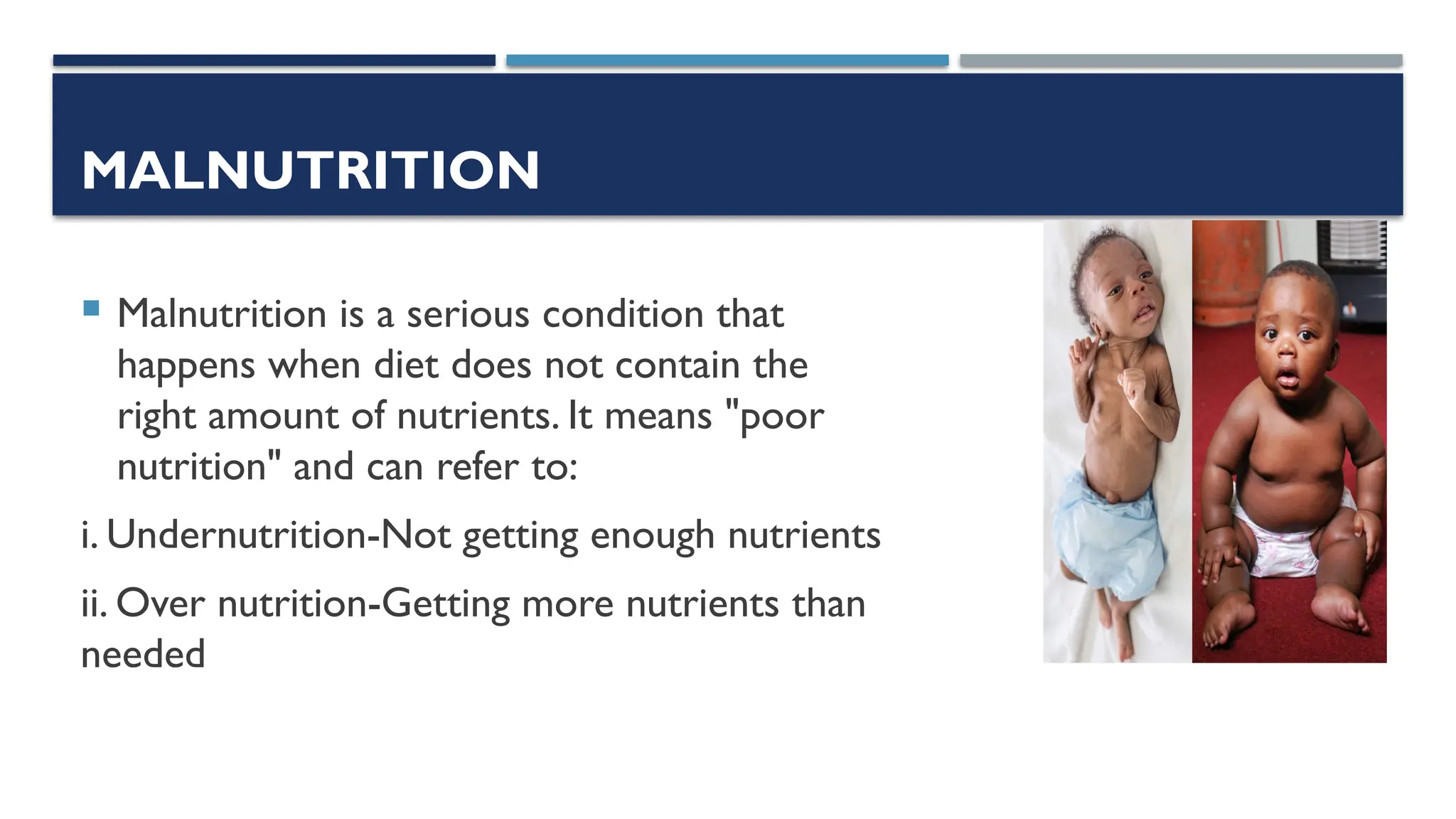 MALNUTRITION
 Malnutrition is a serious condition that
happens when diet does not contain the
right amount of nutrients. It means "poor
nutrition" and can refer to:
i. Undernutrition-Not getting enough nutrients
ii. Over nutrition-Getting more nutrients than
needed
 