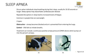 SLEEP APNEA
• Figure 4.14
Occurs when individuals stop breathing during their sleep, usually for 10-20 seconds or
longer. Sleep apnea may exacerbate cardiovascular disease
Repeated disruptions in sleep lead to increased levels of fatigue.
Common in people that are overweight.
2 types:
Obstructive – airway becomes blocked and air is prevented from entering the lungs.
Central – CNS fails to initiate breaths.
Treatment can include a continuous positive airway pressure (CPAP) device which pumps air
into the person’s airways.
 