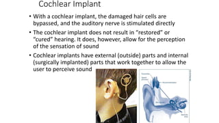 Cochlear Implant
• With a cochlear implant, the damaged hair cells are
bypassed, and the auditory nerve is stimulated directly
• The cochlear implant does not result in “restored” or
“cured” hearing. It does, however, allow for the perception
of the sensation of sound
• Cochlear implants have external (outside) parts and internal
(surgically implanted) parts that work together to allow the
user to perceive sound
 