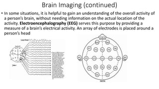 Brain Imaging (continued)
• In some situations, it is helpful to gain an understanding of the overall activity of
a person’s brain, without needing information on the actual location of the
activity. Electroencephalography (EEG) serves this purpose by providing a
measure of a brain’s electrical activity. An array of electrodes is placed around a
person’s head
 