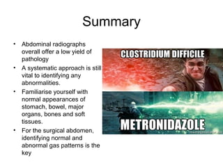Summary
• Abdominal radiographs
overall offer a low yield of
pathology
• A systematic approach is still
vital to identifying any
abnormalities.
• Familiarise yourself with
normal appearances of
stomach, bowel, major
organs, bones and soft
tissues.
• For the surgical abdomen,
identifying normal and
abnormal gas patterns is the
key
 