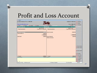 Profit and Loss Account




                          25
 