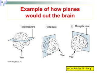 Example of how planes
would cut the brain
 