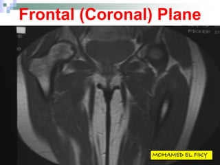 Frontal (Coronal) Plane
 