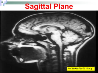 Sagittal Plane
 