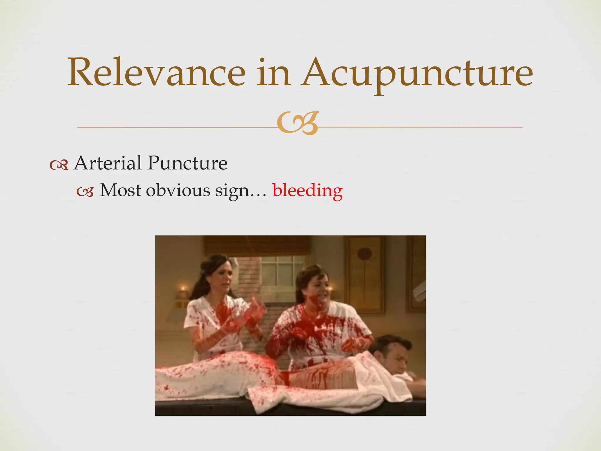 !
" Arterial Puncture
! Most obvious sign… bleeding
Relevance in Acupuncture
 