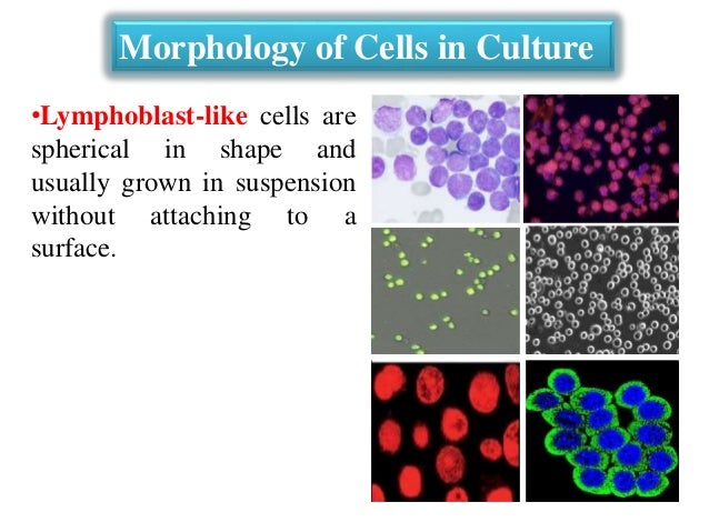 intro animal cell culture This workshop provides a solid basis for the understanding of the growth of animal cells and combines lecture and laboratory exercises topics include: introduction to cell and tissue culture, serum containing media and the use of serum cell counting and viability determination, development of growth curves, growth of adherent and suspension cells, transfection technologies for recombinant . intro animal cell culture This workshop provides a solid basis for the understanding of the growth of animal cells and combines lecture and laboratory exercises topics include: introduction to cell and tissue culture, serum containing media and the use of serum cell counting and viability determination, development of growth curves, growth of adherent and suspension cells, transfection technologies for recombinant .