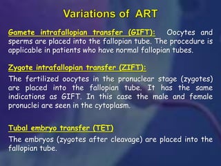 Gamete intrafallopian transfer (GIFT): Oocytes and
sperms are placed into the fallopian tube. The procedure is
applicable in patients who have normal fallopian tubes.
Zygote intrafallopian transfer (ZIFT):
The fertilized oocytes in the pronuclear stage (zygotes)
are placed into the fallopian tube. It has the same
indications as GIFT. In this case the male and female
pronuclei are seen in the cytoplasm.
Tubal embryo transfer (TET)
The embryos (zygotes after cleavage) are placed into the
fallopian tube.
 