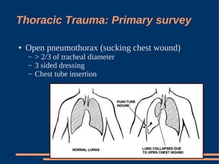 Introduction To ATLS