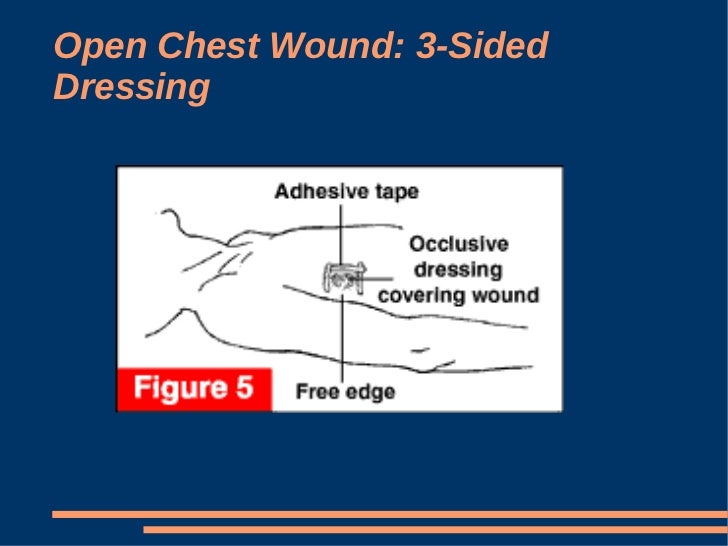 Introduction To ATLS