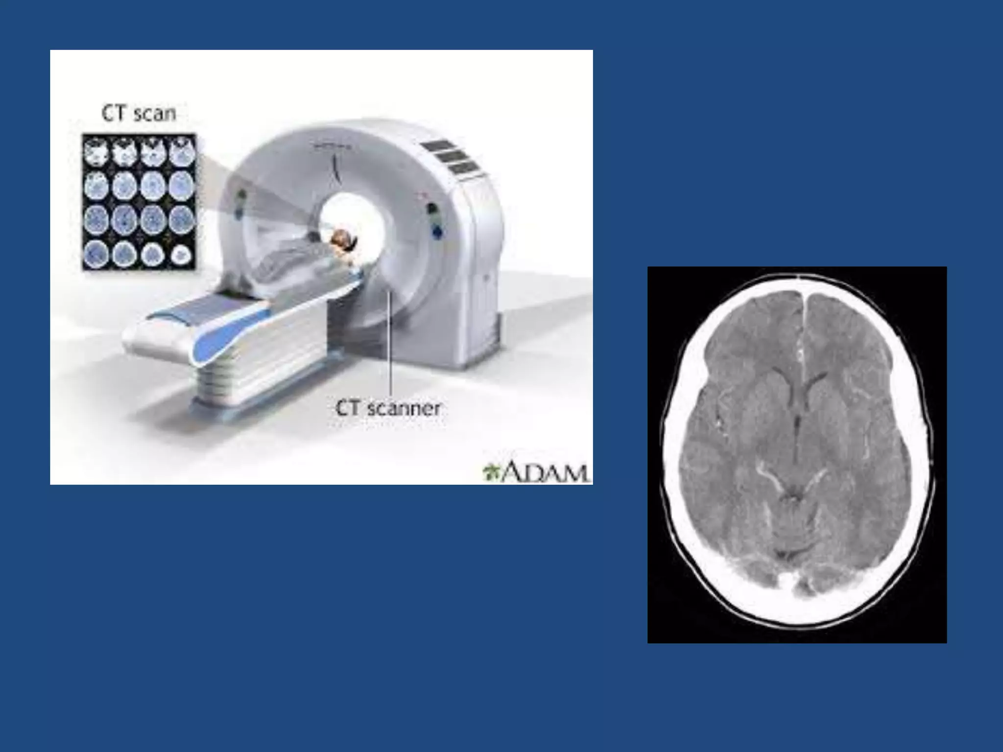 Introduction to basics of radiology | PPTX