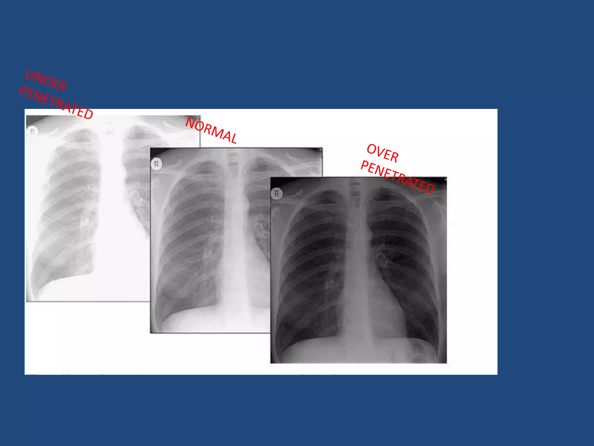 Introduction to basics of radiology | PPTX