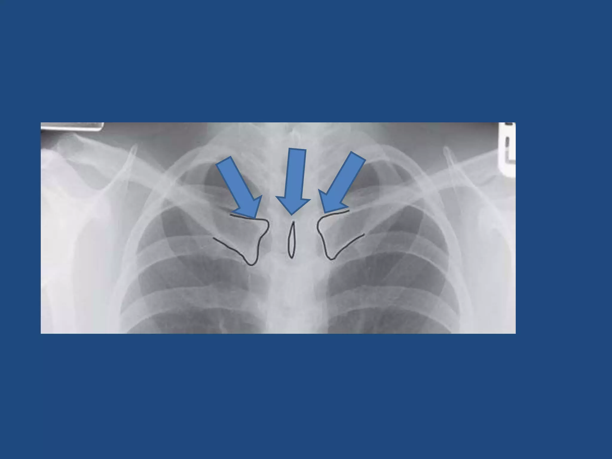 Introduction to basics of radiology | PPTX