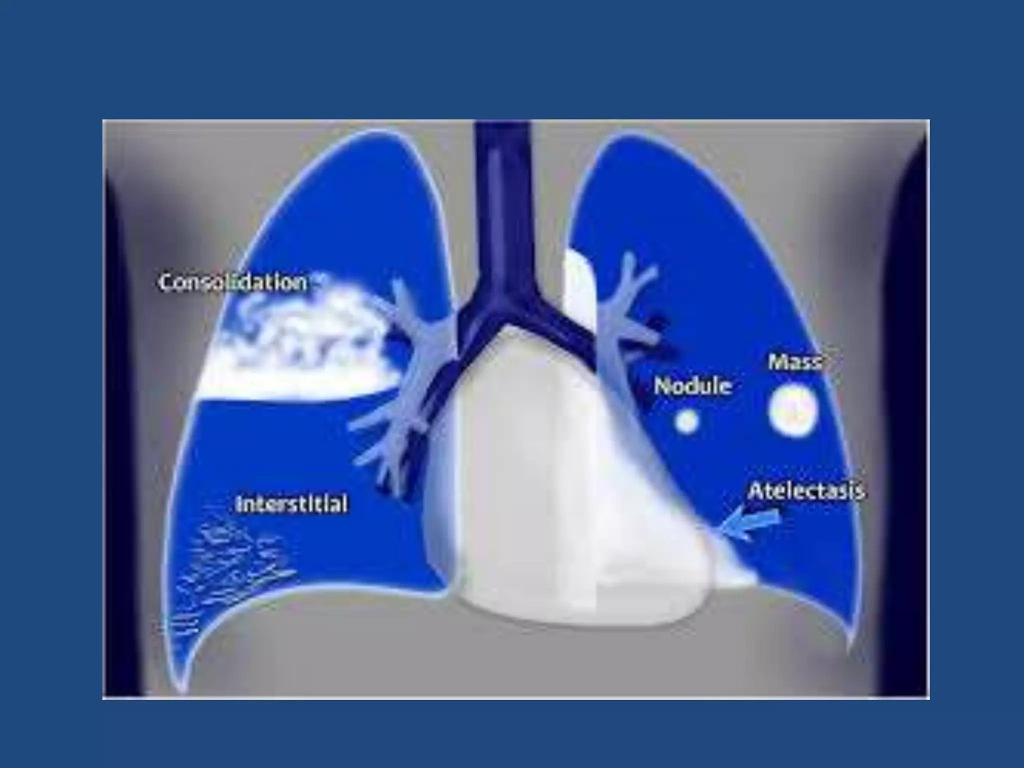 Introduction to basics of radiology | PPTX