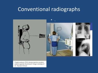 Conventional Radiography Scan Introduction to basics of radiology | PPTX