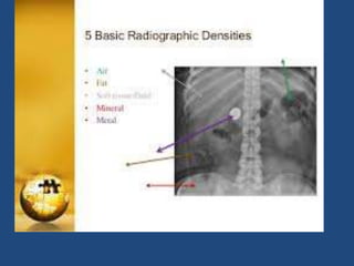 Introduction to basics of radiology | PPTX
