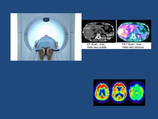 Introduction to basics of radiology | PPTX