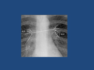 Introduction to basics of radiology | PPTX