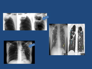 Introduction to basics of radiology | PPTX