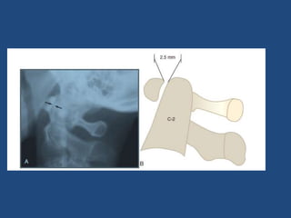 Introduction to basics of radiology | PPTX