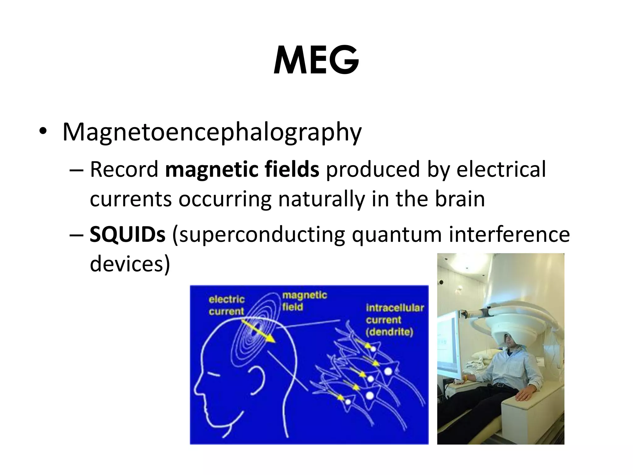 MEG
• Magnetoencephalography
  – Record magnetic fields produced by electrical
    currents occurring naturally in the brain
  – SQUIDs (superconducting quantum interference
    devices)
 