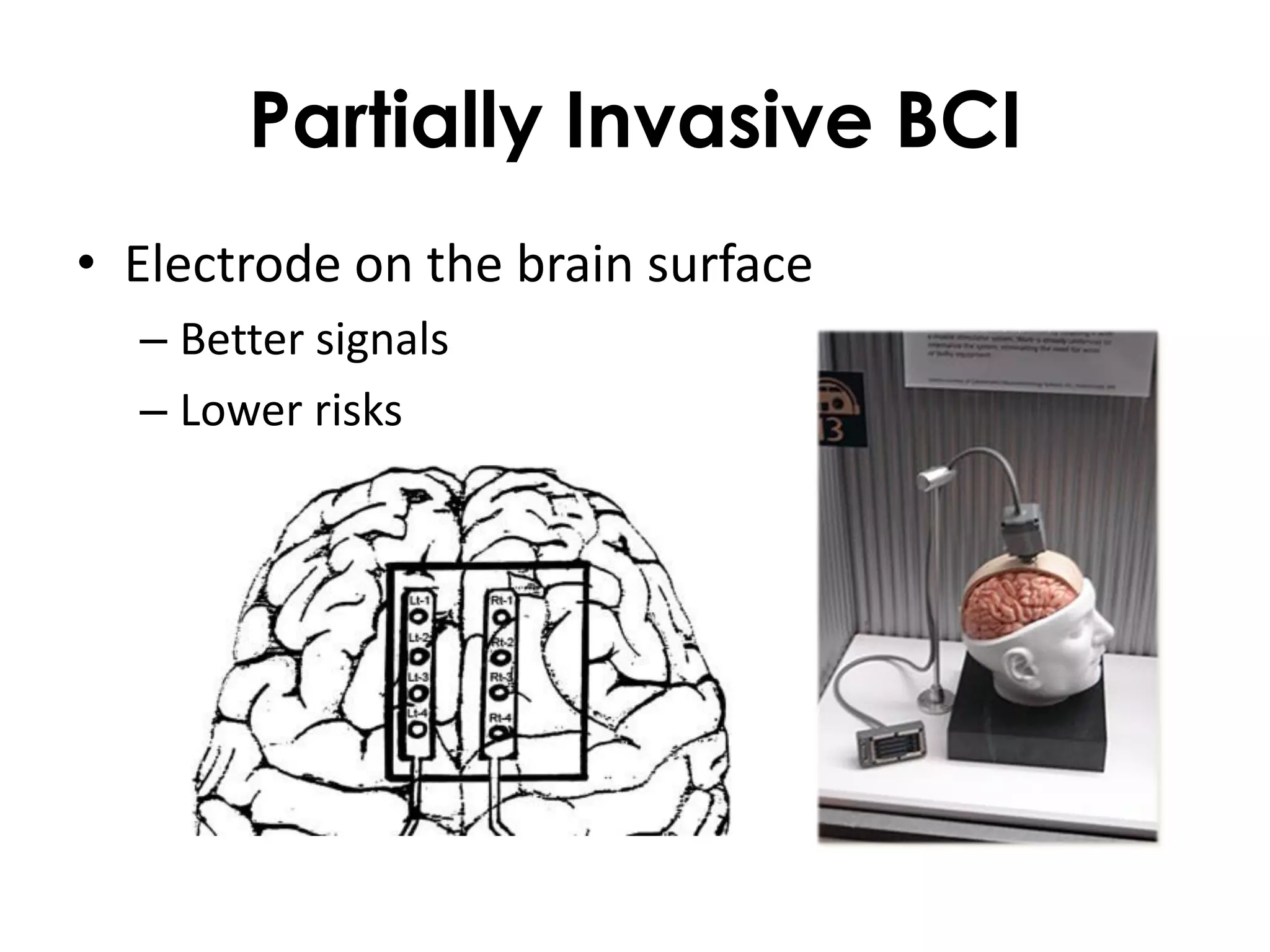 Partially Invasive BCI
• Electrode on the brain surface
  – Better signals
  – Lower risks
 