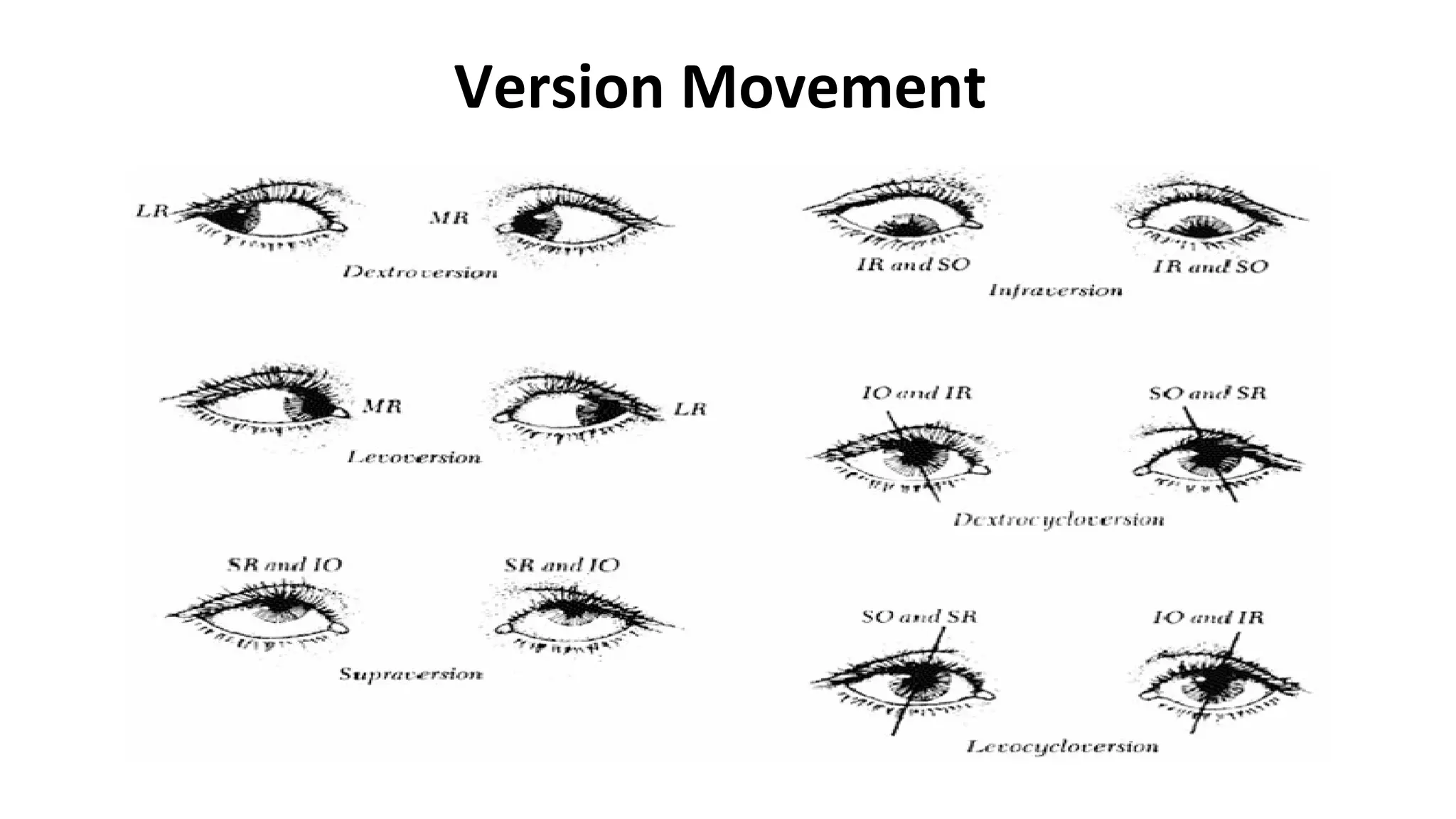 Version Movement
 