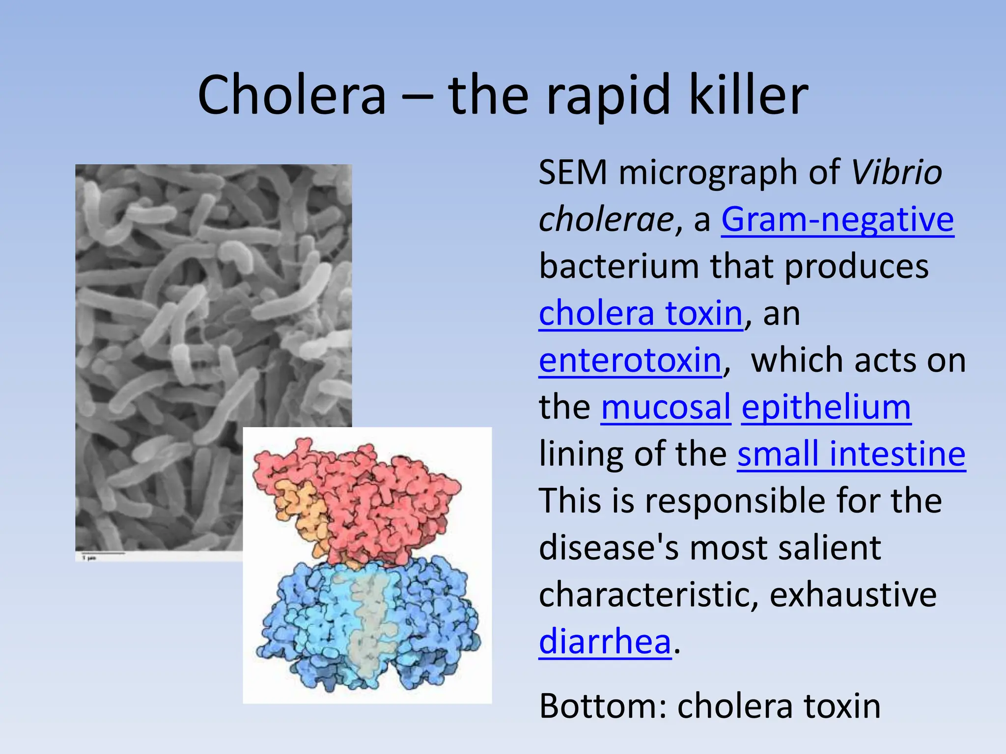 Cholera – the rapid killer
SEM micrograph of Vibrio
cholerae, a Gram-negative
bacterium that produces
cholera toxin, an
enterotoxin, which acts on
the mucosal epithelium
lining of the small intestine
This is responsible for the
disease's most salient
characteristic, exhaustive
diarrhea.
Bottom: cholera toxin
 
