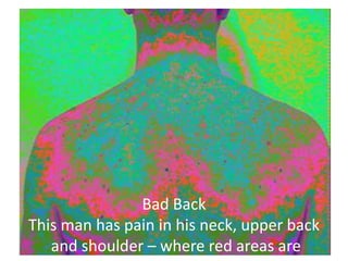 Bad Back
This man has pain in his neck, upper back
and shoulder – where red areas are

 