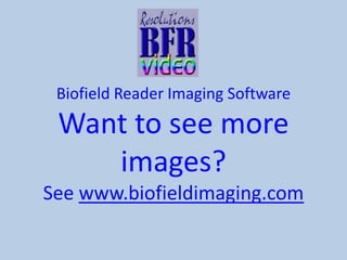 Biofield Reader Imaging Software

Want to see more
images?
See www.biofieldimaging.com

 