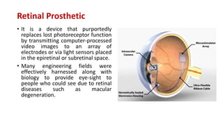 Retinal Prosthetic
• It is a device that purportedly
replaces lost photoreceptor function
by transmitting computer-processed
video images to an array of
electrodes or via light sensors placed
in the epiretinal or subretinal space.
• Many engineering fields were
effectively harnessed along with
biology to provide eye-sight to
people who could see due to retinal
diseases such as macular
degeneration.
 