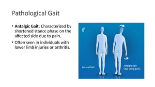 INTRODUCTION TO BIOMECHANICS IN ORTHOPEDICS.pptx