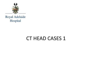 CT HEAD CASES 1
 