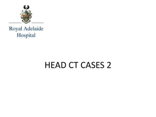 HEAD CT CASES 2
 