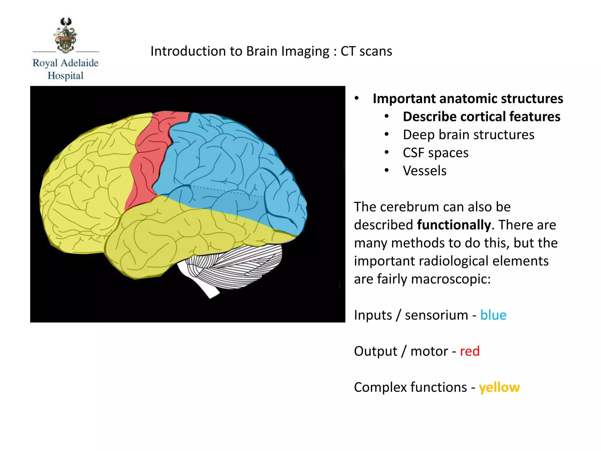 Introduction to Brain Imaging : CT scans
• Important anatomic structures
• Describe cortical features
• Deep brain structures
• CSF spaces
• Vessels
The cerebrum can also be
described functionally. There are
many methods to do this, but the
important radiological elements
are fairly macroscopic:
Inputs / sensorium - blue
Output / motor - red
Complex functions - yellow
 